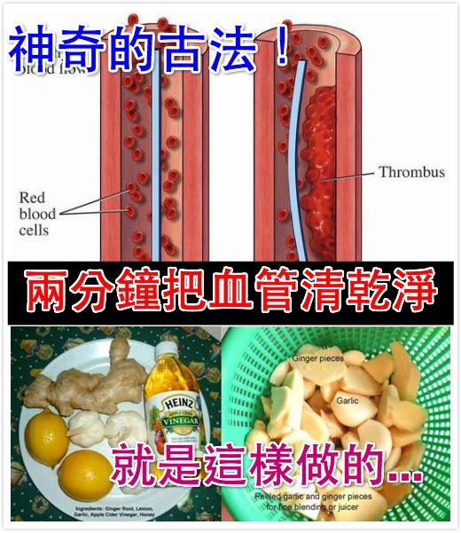 s1_53a57d14c24ea.jpg